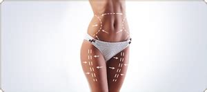 360 Liposuction at LCS Medical Spa Near Me in San Antonio, TX