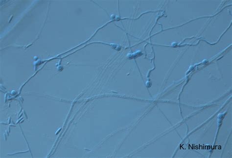 Fusarium oxysporum microscopy-1