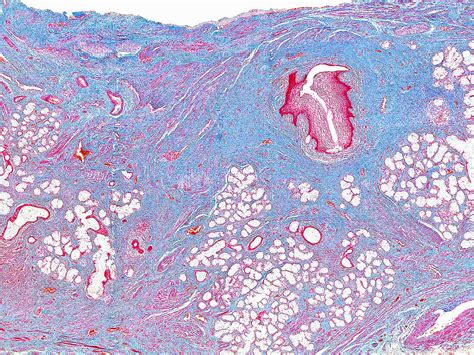 Human Bartholin’s gland, light … – Bild kaufen – 13619784 Science Photo ...