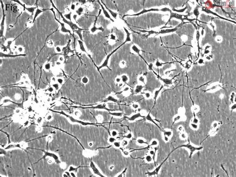 Human Cerebellar Granule Cells (HCGC)