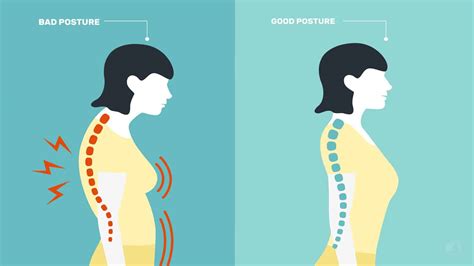 10 Exercises That Fix Posture and Relieve Back Pain