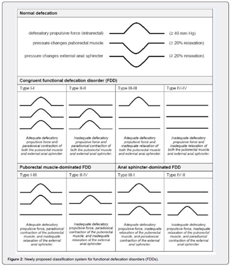 Pelvic Floor Dyssynergia Types | Review Home Co