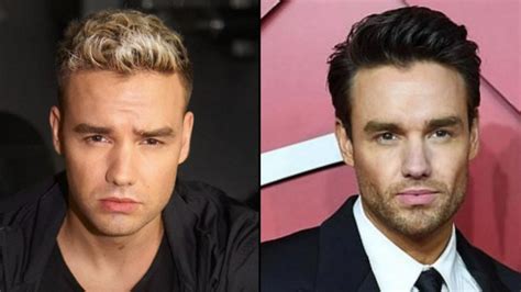 Liam Payne's Stunning Transformation: Facial Features Before and After ...