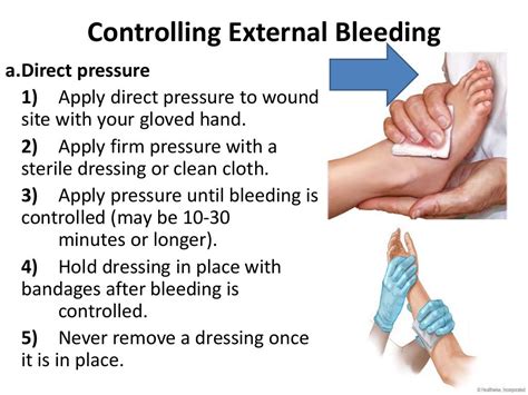 Controlling External Bleeding