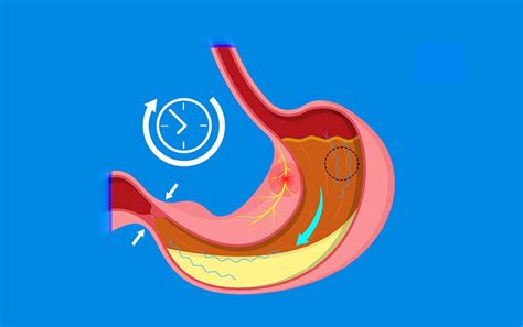 Gastric Emptying Study | Gastro Associates