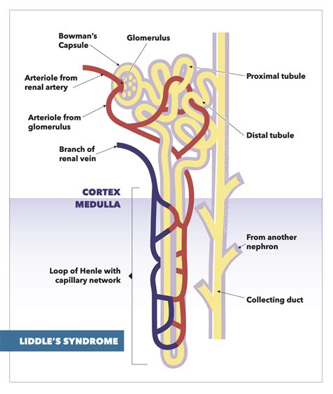 Liddle Syndrome Article