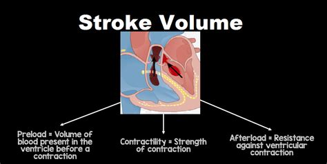 Determinants of Stroke Volume.