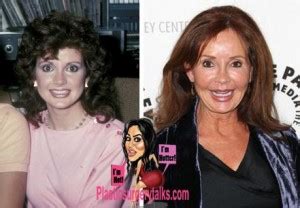 Jackie Zeman Plastic Surgery Before & After - Plastic Surgery Talks