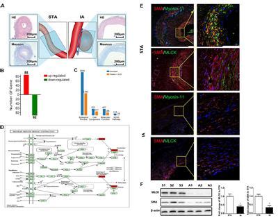 Frontiers | The Effect of Myosin Light Chain Kinase on the Occurrence and Development of ...