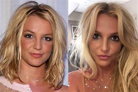 Britney Spears Plastic Surgery: Boob Job, Nose Job, Facelift