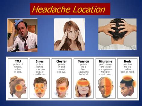 headaches - Google Search | Headache location, Headache, Headache chart