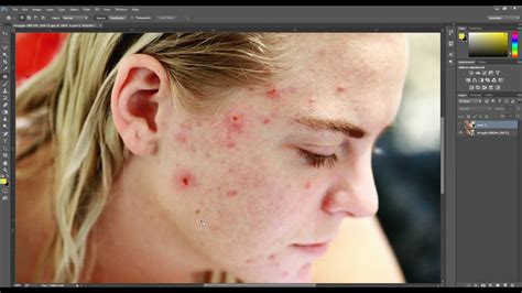 Remove pimple from your face just in FEW clicks PHOTOSHOP TUTORIAL - YouTube