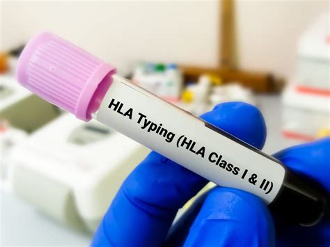 What is the HLA? - DNA GENICS BLOG