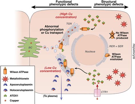 Figure 1 from Defining Wilson Disease Phenotypes : From the Patient to ...