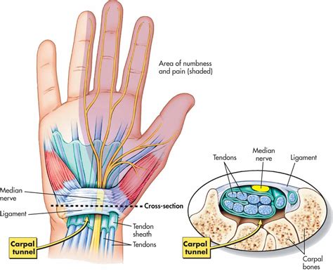 The Wrist And Carpal Tunnel - CoreWalking