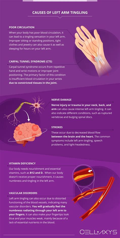 What Causes Left Arm Tingling? How To Treat It? - Cellaxys