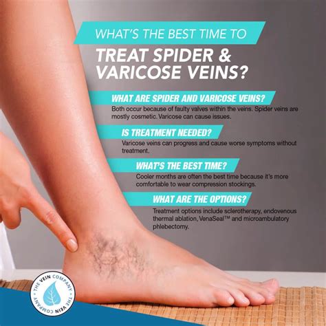 Do Laser Treatments for Spider & Varicose Veins Hurt? – The Vein Company