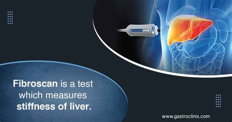 Fibroscan - Dr. Harsh J Shah