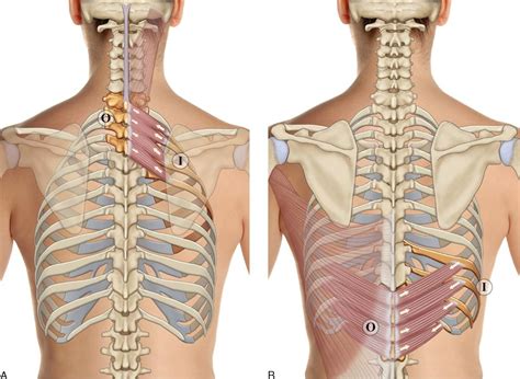 8. Muscles of the Spine and Rib Cage | Musculoskeletal Key