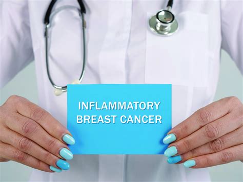 Medical,Concept,About,Inflammatory,Breast,Cancer,With,Phrase,On,The ...