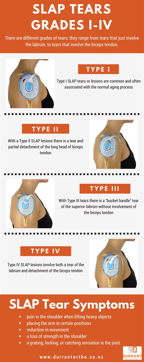 SLAP Tear: A Comprehensive Guide to Labrum Injuries