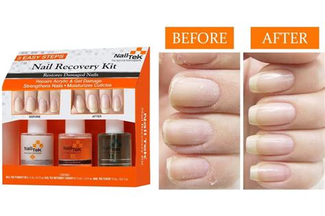 Top 10 Best Nail Growth Products of (2024) Review – Any Top 10