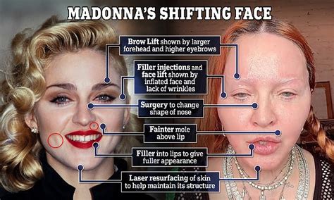 EXCLUSIVE: Plastic surgeon charts Madonna's facial tweaks over the ...