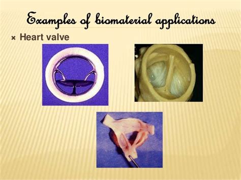 Biomaterials and its applications.