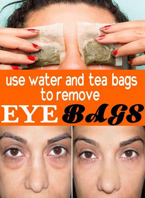 How To Get Rid Of Bags Under Eyes Fast Best Home Remedies | Eye bags, Remove eye bags, Undereye