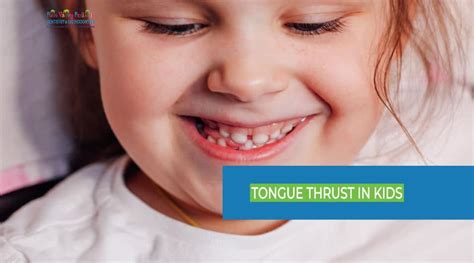 Tongue Thrust in Kids: Causes, Diagnosis, and Treatment