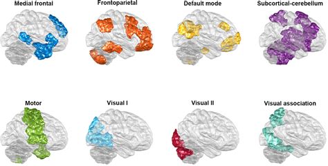 Bipolar Disorder Brain