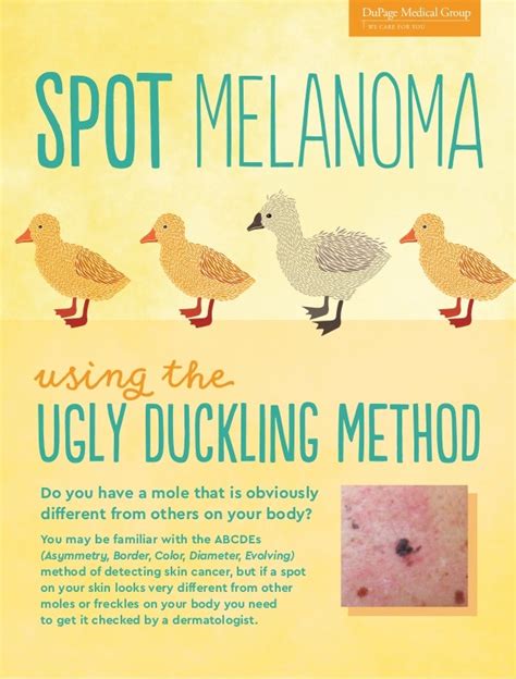 Spot Melanoma...Using the Ugly Duckling Method