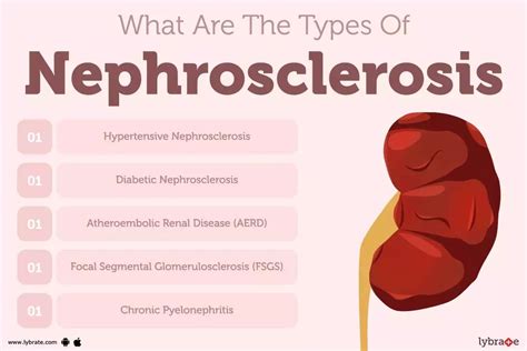 Nephrosclerosis: Causes, Symptoms, Treatment and Cost