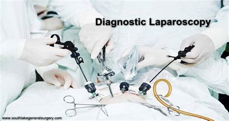 Diagnostic Laparoscopy Procedure and Recovery - Southlake General Surgery