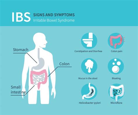 Irritable Bowel Syndrome - IBS Symptoms - Northern Virginia ...