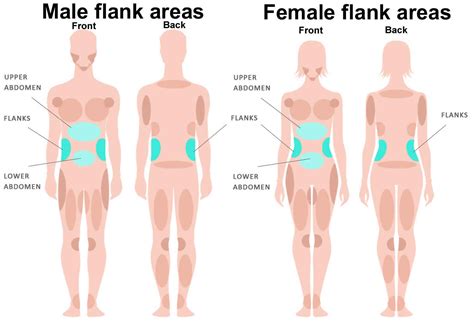 Flank pain cause - left flank pain causes and right flank pain causes