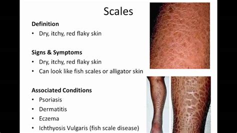 Unit 5 - 4. Dermatological Conditions - YouTube