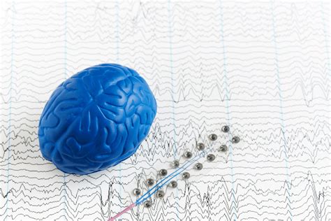 Research Case Study: Tapping to Heal from Traumatic Brain Injury