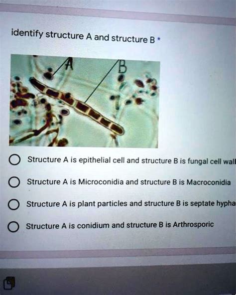 SOLVED: Structure A is an epithelial cell, and structure B is a fungal cell wall. Structure A is ...