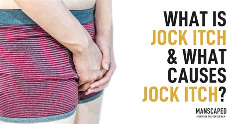 What is Jock Itch and What Causes Jock Itch? – Manscaped