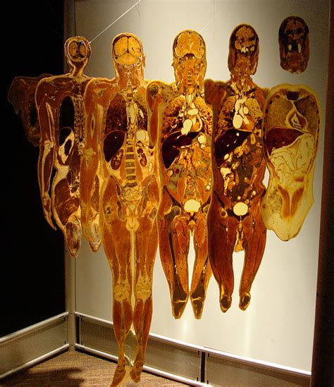 Two tales of one city: The Bodyworlds exhibition: “Macabre freak circus or exploration of the ...