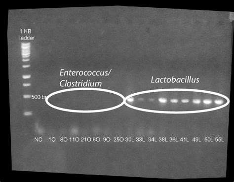 Amplification of the oxc gene. All Lactobacillus isolates exhibited a... | Download Scientific ...