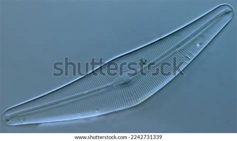 Diatom Cell Under Dic Microscope Stock Photo 2242731339 | Shutterstock