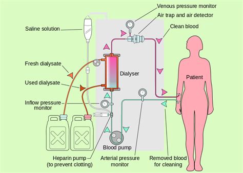 Dialysis- Dialysis Meaning, Dialysis Machine & Procedure