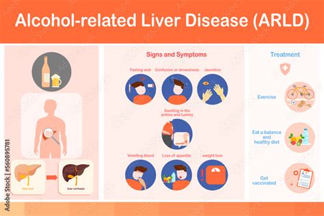 Vector illustration.infographic Signs and Symptoms of Alcoholic Fatty ...