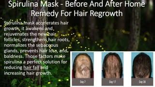 Superfood spirulina benefits hair loss and regrowth | PPT