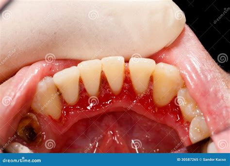 Dentist Examining Sick Mouth Stock Image - Image: 30587265