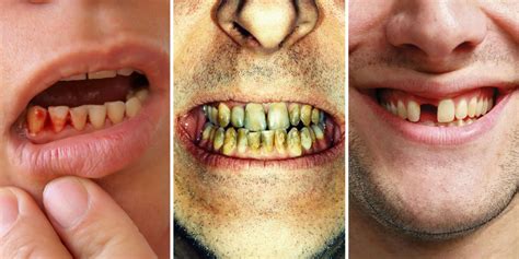 What Teeth Problems Can Tell You About Your Health - Dental Problems Can Be an Early Warning ...