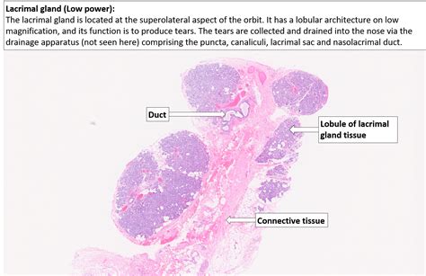 Orbit – Lacrimal gland – NUS Pathweb :: NUS Pathweb