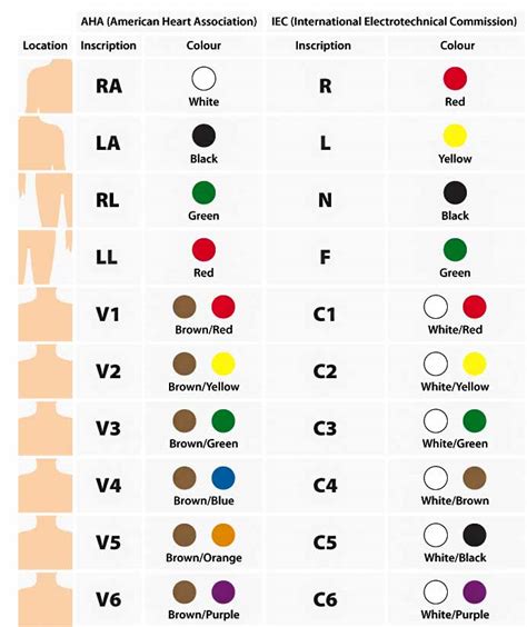 12 Lead Ecg Placement Color Coded